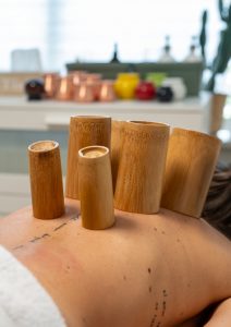 Hijama-cupping-and-more-25